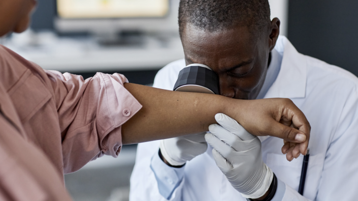 Psoriasis Specialist Appointments in Chesapeake Beach Maryland